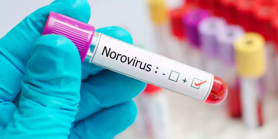 Why Norovirus Outbreaks Are Surging This Season: What You Need to Know