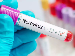 Why Norovirus Outbreaks Are Surging This Season: What You Need to Know